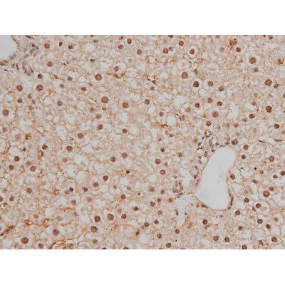 Phospho-SP1 (Thr453) Antibody in Immunohistochemistry (Paraffin) (IHC (P))