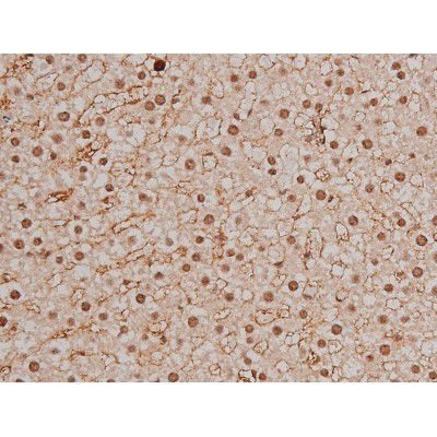 Phospho-SP1 (Thr453) Antibody in Immunohistochemistry (Paraffin) (IHC (P))