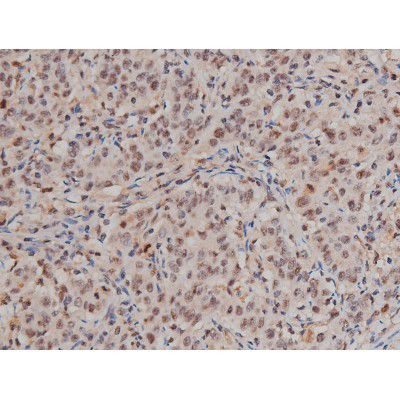 Phospho-SP1 (Thr453) Antibody in Immunohistochemistry (Paraffin) (IHC (P))