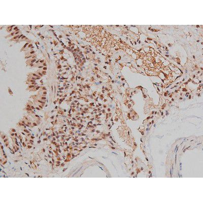 Phospho-SP1 (Thr453) Antibody in Immunohistochemistry (Paraffin) (IHC (P))