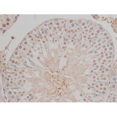 Phospho-SP1 (Thr453) Antibody in Immunohistochemistry (Paraffin) (IHC (P))