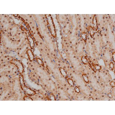 Phospho-SP1 (Thr453) Antibody in Immunohistochemistry (Paraffin) (IHC (P))