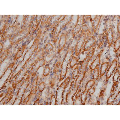 Phospho-SP1 (Thr453) Antibody in Immunohistochemistry (Paraffin) (IHC (P))