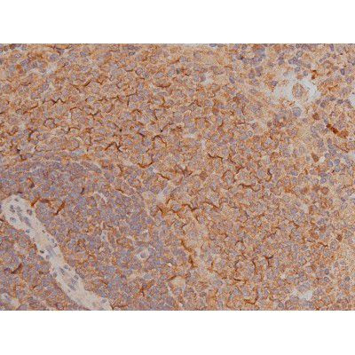 Phospho-SP1 (Thr739) Antibody in Immunohistochemistry (Paraffin) (IHC (P))