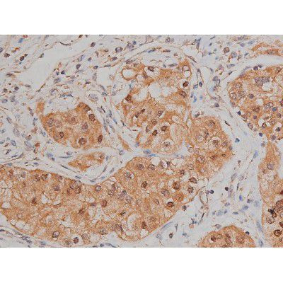 Phospho-SP1 (Thr739) Antibody in Immunohistochemistry (Paraffin) (IHC (P))