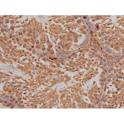 Phospho-SP1 (Thr739) Antibody in Immunohistochemistry (Paraffin) (IHC (P))