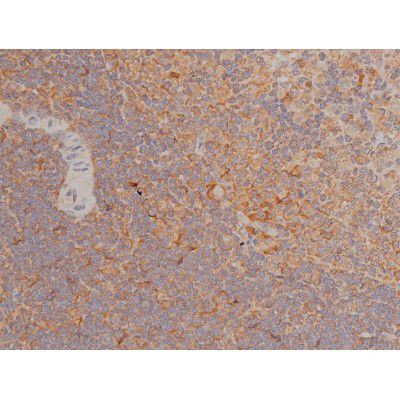 Phospho-SP1 (Thr739) Antibody in Immunohistochemistry (Paraffin) (IHC (P))