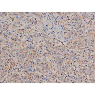 Phospho-SP1 (Thr739) Antibody in Immunohistochemistry (Paraffin) (IHC (P))