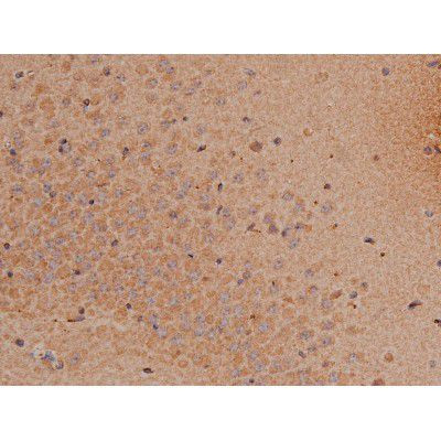 Phospho-SP1 (Thr739) Antibody in Immunohistochemistry (Paraffin) (IHC (P))