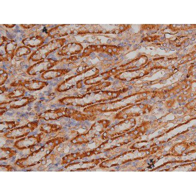 Phospho-SP1 (Thr739) Antibody in Immunohistochemistry (Paraffin) (IHC (P))