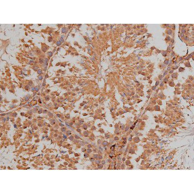 Phospho-SP1 (Thr739) Antibody in Immunohistochemistry (Paraffin) (IHC (P))