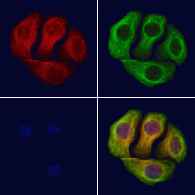 Phospho-IGF1R (Tyr1346) Antibody in Immunocytochemistry (ICC/IF)