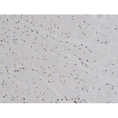 Phospho-IGF1R (Tyr1346) Antibody in Immunohistochemistry (Paraffin) (IHC (P))