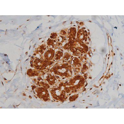 Phospho-IGF1R (Tyr1346) Antibody in Immunohistochemistry (Paraffin) (IHC (P))