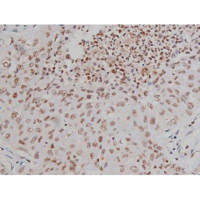 Phospho-IGF1R (Tyr1346) Antibody in Immunohistochemistry (Paraffin) (IHC (P))