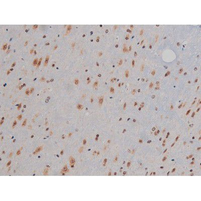 Phospho-IGF1R (Tyr1346) Antibody in Immunohistochemistry (Paraffin) (IHC (P))