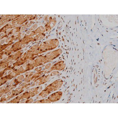 Phospho-IGF1R (Tyr1346) Antibody in Immunohistochemistry (Paraffin) (IHC (P))