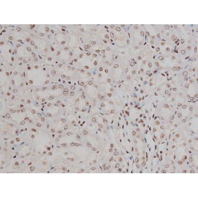 Phospho-IGF1R (Tyr1346) Antibody in Immunohistochemistry (Paraffin) (IHC (P))