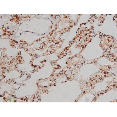 Phospho-IGF1R (Tyr1346) Antibody in Immunohistochemistry (Paraffin) (IHC (P))