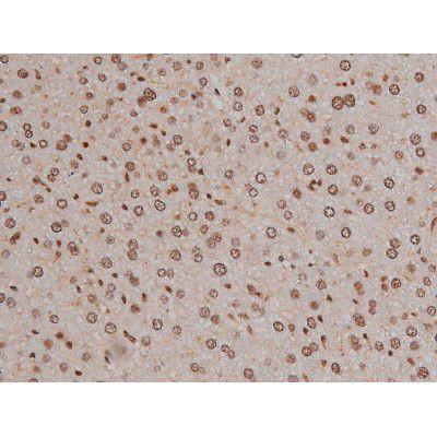 Phospho-IGF1R (Tyr1346) Antibody in Immunohistochemistry (Paraffin) (IHC (P))