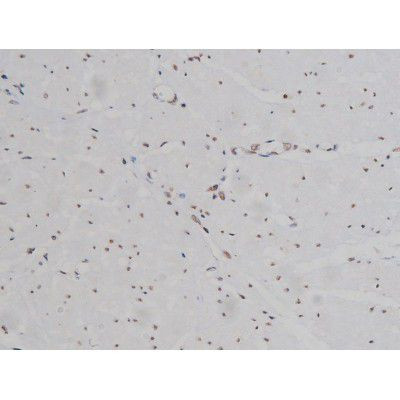 Phospho-IGF1R (Tyr1346) Antibody in Immunohistochemistry (Paraffin) (IHC (P))