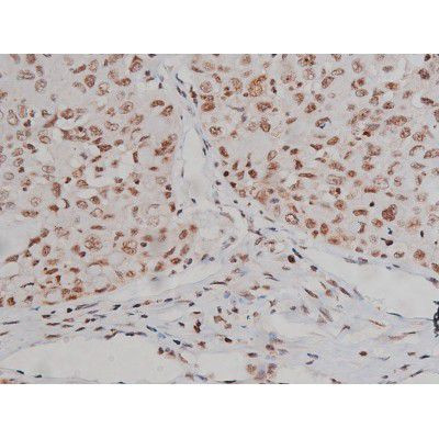 Phospho-IGF1R (Tyr1346) Antibody in Immunohistochemistry (Paraffin) (IHC (P))