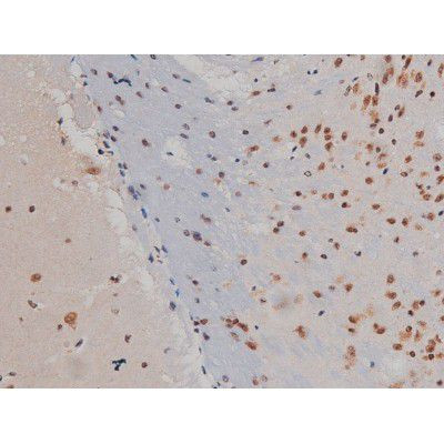 Phospho-IGF1R (Tyr1346) Antibody in Immunohistochemistry (Paraffin) (IHC (P))