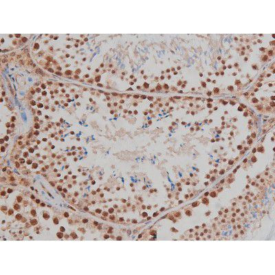 Phospho-IGF1R (Tyr1346) Antibody in Immunohistochemistry (Paraffin) (IHC (P))