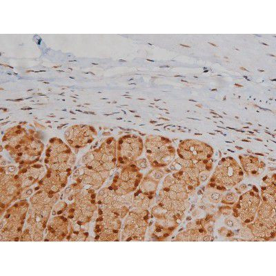 Phospho-IGF1R (Tyr1346) Antibody in Immunohistochemistry (Paraffin) (IHC (P))