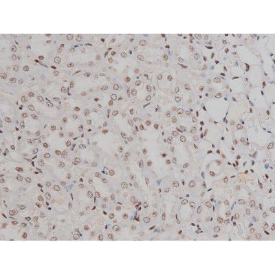 Phospho-IGF1R (Tyr1346) Antibody in Immunohistochemistry (Paraffin) (IHC (P))