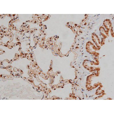 Phospho-IGF1R (Tyr1346) Antibody in Immunohistochemistry (Paraffin) (IHC (P))