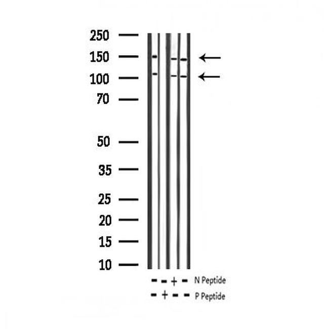 Phospho-IGF1R (Tyr1346) Antibody in Western Blot (WB)