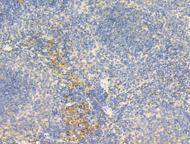 Phospho-IGF1R (Tyr1161) Antibody in Immunohistochemistry (Paraffin) (IHC (P))