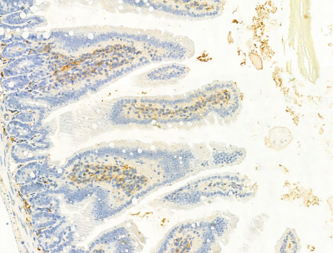 Phospho-IGF1R (Tyr1161) Antibody in Immunohistochemistry (Paraffin) (IHC (P))