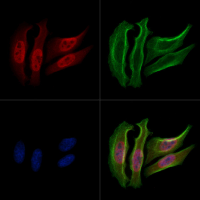 Phospho-HSP90 (Ser255) Antibody in Immunocytochemistry (ICC/IF)