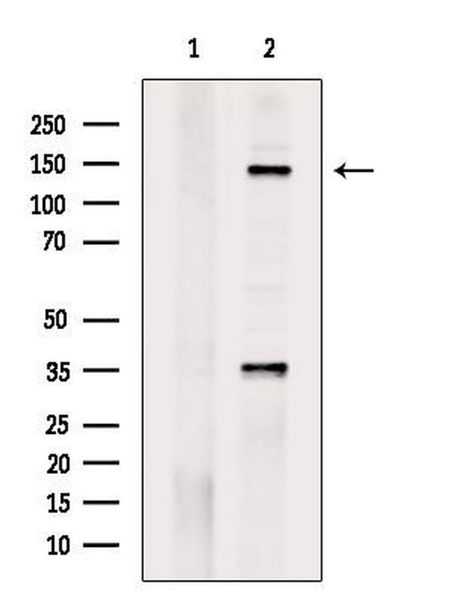 Phospho-Met (Tyr1234) Antibody in Western Blot (WB)