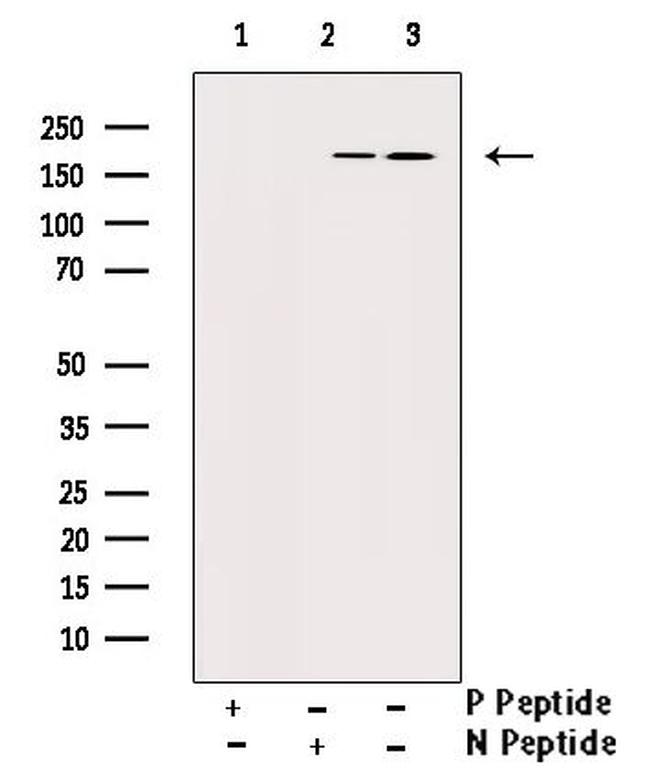 Phospho-PDGFRB (Tyr740) Antibody in Western Blot (WB)