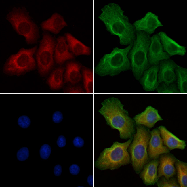 Phospho-FGFR1 (Tyr766) Antibody in Immunocytochemistry (ICC/IF)