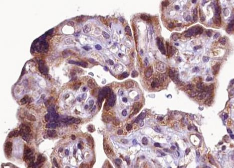 Phospho-FGFR1 (Tyr766) Antibody in Immunohistochemistry (Paraffin) (IHC (P))