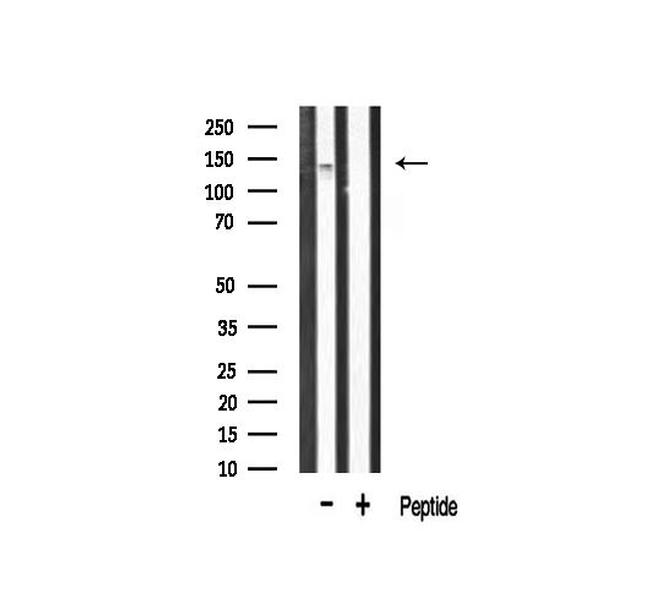 Phospho-FGFR1 (Tyr766) Antibody in Western Blot (WB)