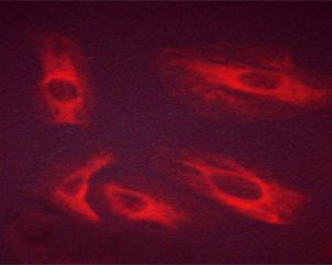 Phospho-FGFR1 (Tyr654) Antibody in Immunocytochemistry (ICC/IF)