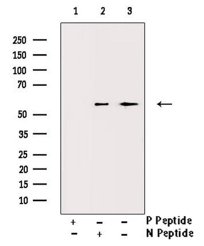 Phospho-VDR (Ser208) Antibody in Western Blot (WB)