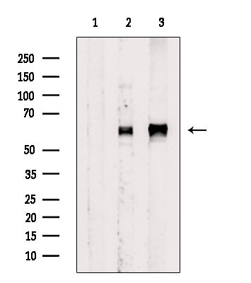 Phospho-SRC (Tyr530) Antibody in Western Blot (WB)
