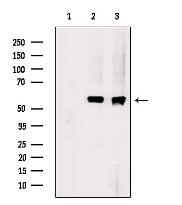 Phospho-SRC (Tyr530) Antibody in Western Blot (WB)