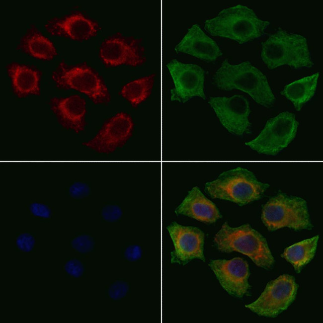 Phospho-Ezrin (Tyr354) Antibody in Immunocytochemistry (ICC/IF)