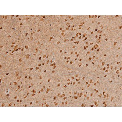 Phospho-Ezrin (Tyr354) Antibody in Immunohistochemistry (Paraffin) (IHC (P))