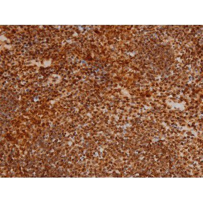 Phospho-Ezrin (Tyr354) Antibody in Immunohistochemistry (Paraffin) (IHC (P))