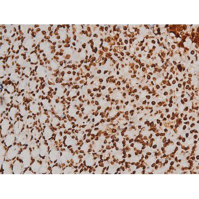 Phospho-Ezrin (Tyr354) Antibody in Immunohistochemistry (Paraffin) (IHC (P))