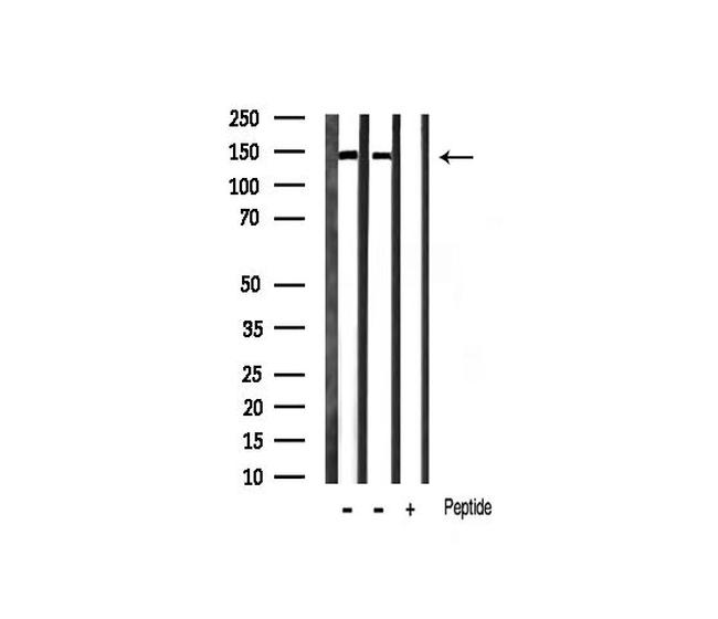 Phospho-Ezrin (Tyr354) Antibody in Western Blot (WB)