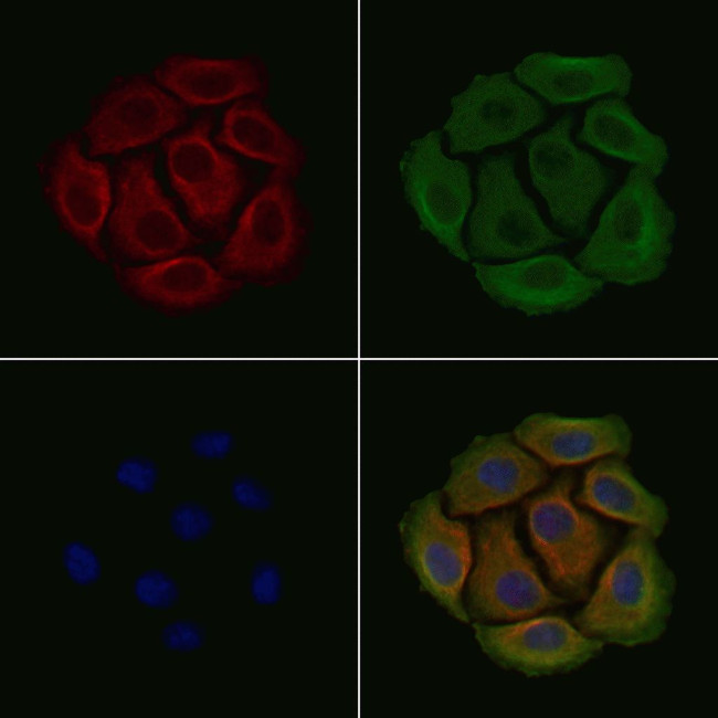 Phospho-Ezrin (Tyr478) Antibody in Immunocytochemistry (ICC/IF)